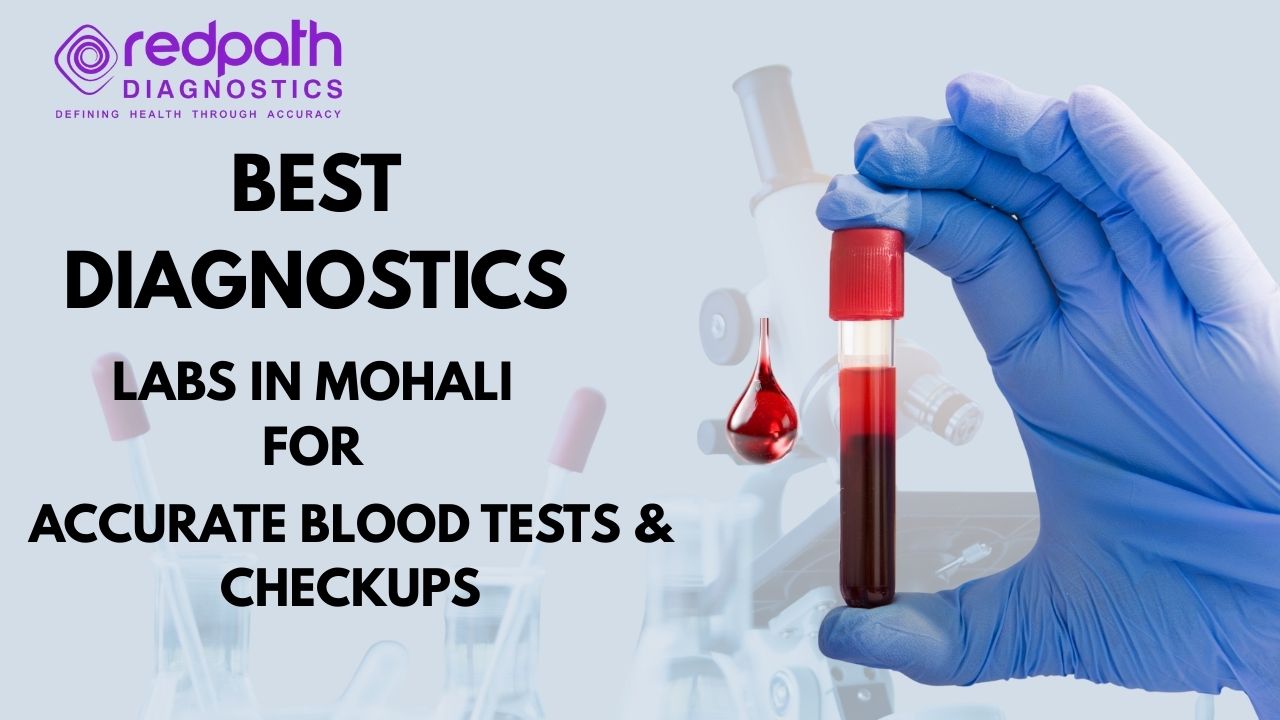 Best Diagnostics Labs in Mohali for Accurate Blood Tests & Checkups