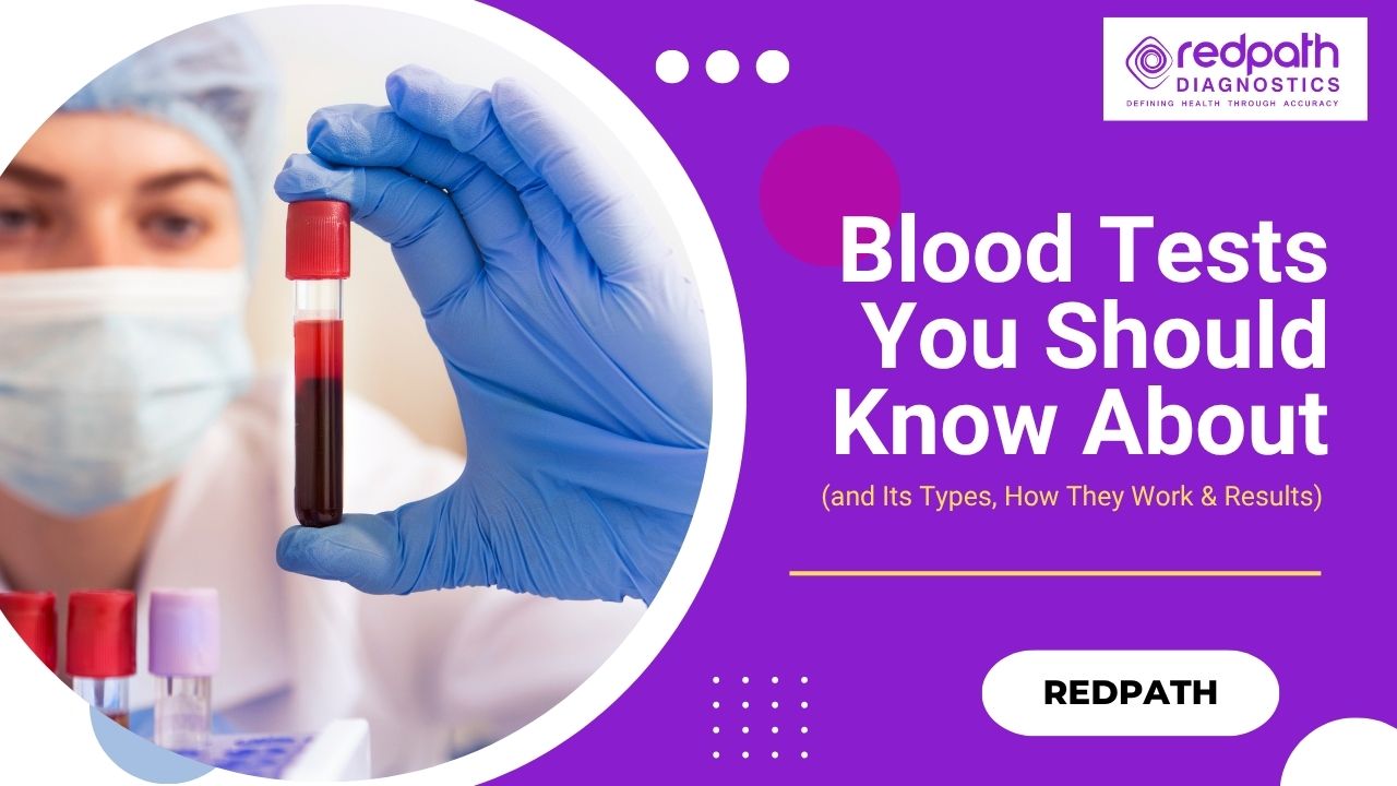 Blood Tests You Should Know About (and Its Types, How They Work & Results)